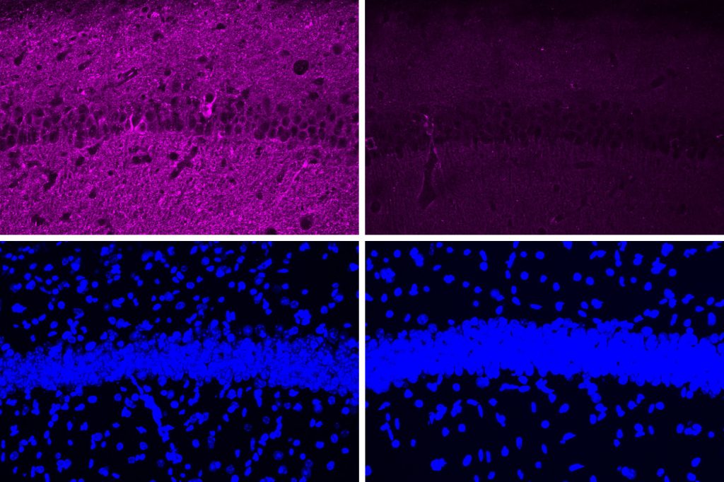 Four panels in a 2x2 array. The top left shows a lot of purple staining of cells. The top right shows much less purple. The bottom row shows two nearly idential stripes of blue with lots of blue spots above and below.